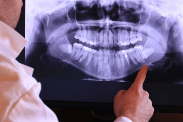 Best Walk-In Emergency Dentist in Prairie View, TX
